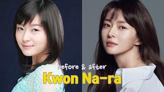 Kwon Na-ra before and after