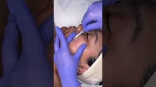 ASMR Dermaplaning  