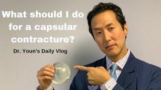 What Should I do for a Capsular Contracture? Dr. Youns Daily Vlog