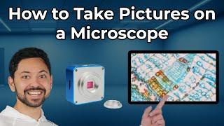 What Kind of Microscope Camera you Should Buy