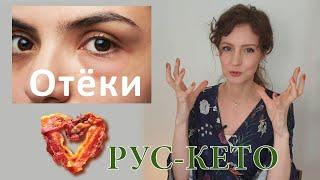 Как бороться с отеками