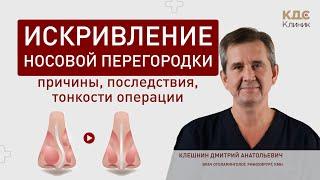 Искривление носовой перегородки - причины последствия детали операции септопластики