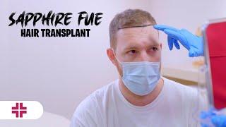 Sapphire Fue Hair Transplant-2023