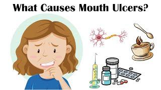 What Causes Mouth Ulcers Canker Sores