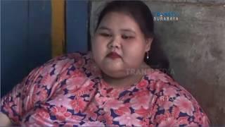 Gadis Obesitas Berbobot asal Lamongan Bersedia Dirujuk ke Rumah Sakit