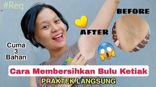 Cabut Bulu Ketek  shella ya