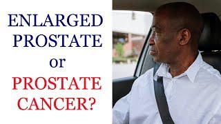 Why black men must know the health of their prostate - Enlarged Prostate or Cancer?