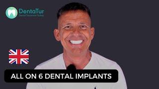 All On 6 Dental Implants in Turkey  Dentatur Ashley Evans from UK