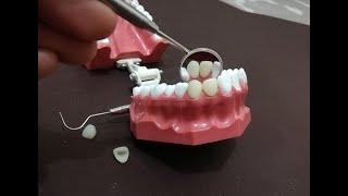 Geçici Diş Yapımı Bölüm 2 - Geçici Kron yapımı - Akrilik Hazırlama - Piyasemenle Şekil Verme
