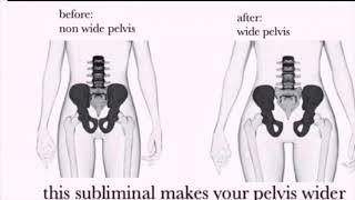 cherry wide pelvis sub extended