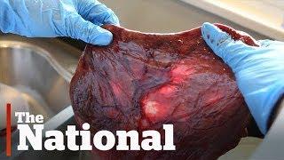 Dont eat placenta medical experts say