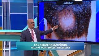 Saç kıran nasıl tedavi edilir? Balçiçek ile Dr. Cankurtaran 50. Bölüm