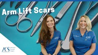 Arm Lift Surgery Scars Types Location How to Hide Them Healing Time & More