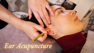 Special EAR MASSAGE and ACUPUNCTURE For YOU Soft Spoken ASMR