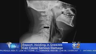 Dont Hold It -- Powerful Sneezes Can Cause Major Damage