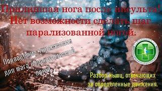 Упражнения для тренировки первого шага при парализации после инсульта.