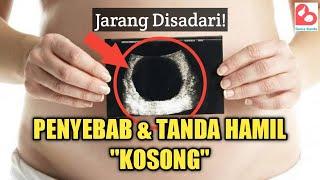 Penyebab dan Tanda-tanda Hamil Kosong