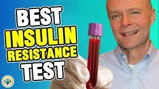 Insulin Resistance Test Best Test for IR & Stubborn Weight Loss Homa-IR