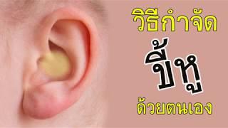 วิธีกำจัดขี้หูด้วยตนเอง ขี้หูอุดตัน ทำง่ายๆ สะอาดหมดจด
