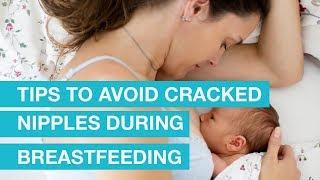 Tips to Avoid Cracked nipples during Breastfeeding