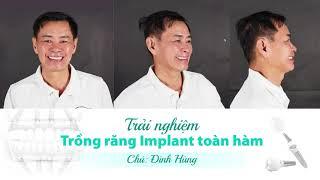 REVIEW Trồng răng implant toàn hàm có thật sự tốt như lời đồn?