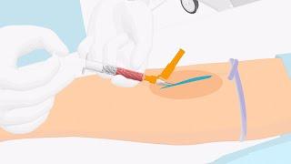 How to properly handle a venous blood gas sample