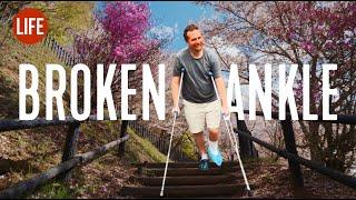 I broke my leg at Japans most iconic location  Life in Japan EP 261