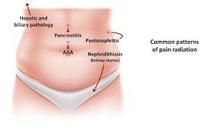 An Approach to Acute Abdominal Pain