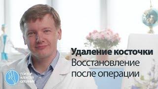 КОСТОЧКИ НА НОГАХ после операции по исправлению деформации Hallux Valgus  Доктор Алексей Олейник