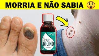 O Que Quase Ninguém Sabe Sobre o ÓLEO DE RÍCINO Porque Não Fiz Isso Antes 