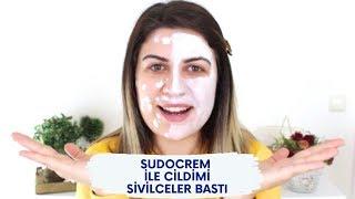 Sudocrem ile Yüzümü Sivilceler Bastı  SİVİLCE YAPAN KREM