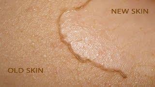 How To Remove Dead Skin Naturally At Home  Home Remedies