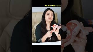 बच्चेदानी का मुख खुला है या नहीं ? HOW TO CONCEIVE PREGNANCY FAST #drpriyankayadav #pregnancy