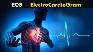 Why ECG Electrocardiogram is performed?