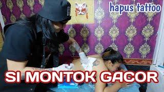 SI MONTOK GACOR  hapus tattoo