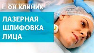 Лазерная шлифовка лица или фракционное омоложение кожи 2020