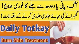 jalay huay ka ilaj  how to treat burn skin in urdu  totkay in urdu  saima gill voice