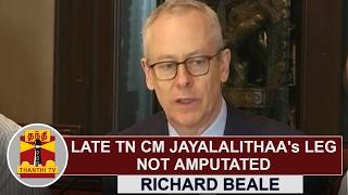 Late Tamil Nadu CM Jayalalithaas leg not amputated  London Doctor Richard Beale  Thanthi TV