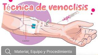 Técnica de venoclisis Teoría #enfermería como instalar una veniclisis catéter venoso periférico