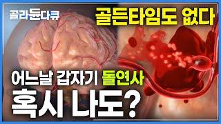 어느 날 갑자기 생긴 두통 혹시 나도 뇌동맥류?│뇌동맥류의 전조 증상과 원인 그리고 예방법까지│골든타임도 없는 내 머릿속의 시한폭탄│명의│#골라듄다큐