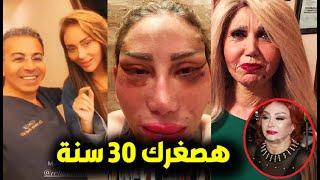 خناقة ريهام سعيد وطبيب التجميل اللبناني بعد ما شوه وشهاهقاضيكي بالمحاكم  وترد عليه بالحقيقة الصدمة