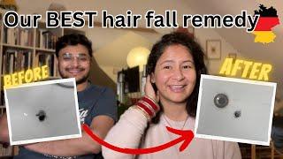 My Hair fall story in Germany   Remedies to control hair fall in Germany
