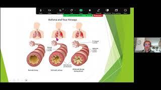 شناخت دلایل و مدیریت مشکل نفس تنگی آسم و بررسی نقش بیمار و پزشک - دکتر قدسی مدنی