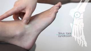 Sinus tarsi syndroom