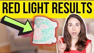 DO LED LIGHT MASKS REALLY WORK?  Dermatologist reviews Omnilux