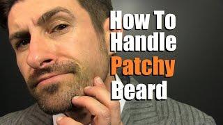 How To Deal With A Patchy Beard  Bald Spot Reduction Tips