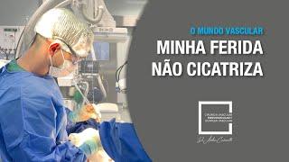 MINHA FERIDA NÃO CICATRIZA PROBLEMA DE CIRCULAÇÃO