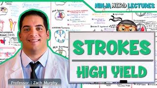 Ischemic and Hemorrhagic Strokes  High Yield