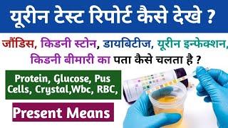 How to Read Urine Routine Test Report   Urine Test Report Explain in Hindi