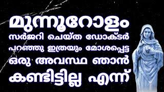 മുന്നൂറോളം സർജറി ചെയ്ത ഡോക്ടർ പറഞ്ഞു ഇത്രയും മോശപ്പെട്ട ഒരു അവസ്ഥ ഞാൻ കണ്ടിട്ടില്ല എന്ന്